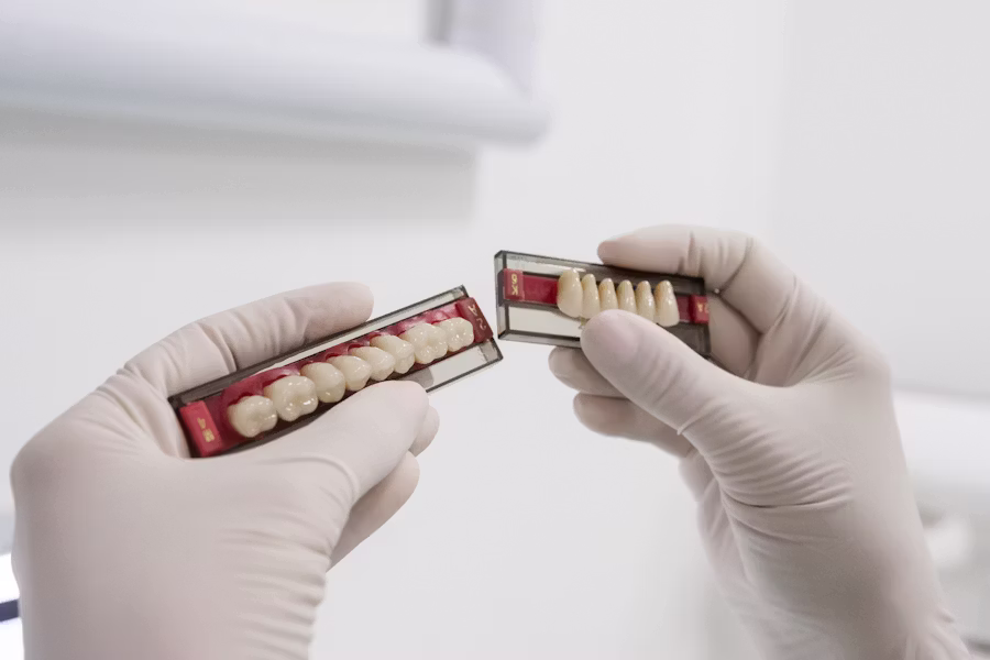 Cura dell'impianto dentale — Studio Odontoiatrico ABB