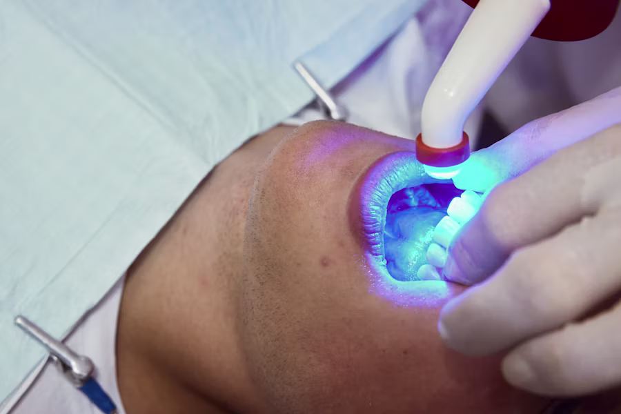 Sbiancamento denti professionale in studio — Studio Odontoiatrico ABB