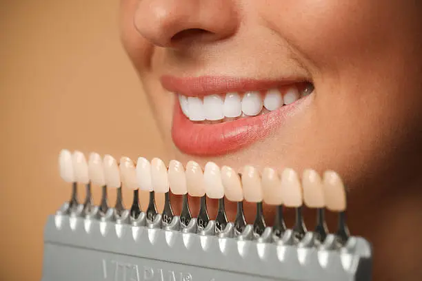 Sorriso perfetto con trattamenti di estetica dentale — Studio Odontoiatrico ABB